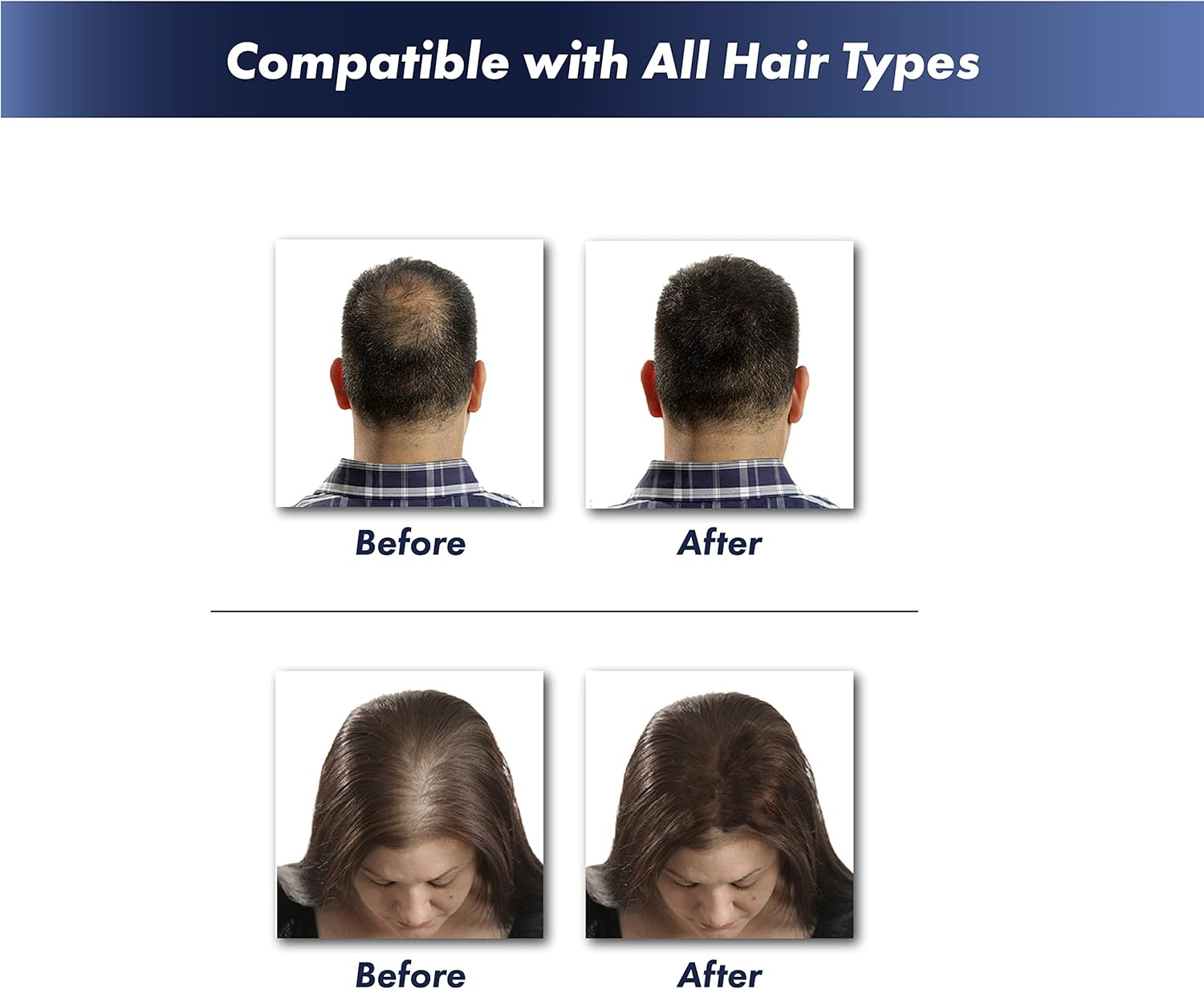 KeraFiber Hair Fibres 28g